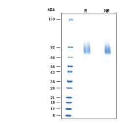 R DSystems Recombinant Human Sialate O-acetylesterase/SIAE His-tag, CF 20 &mu;g | Buy Online | R&amp;DSystems&trade; | Fisher Scientific