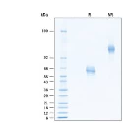 R DSystems Recombinant Human R-Spondin 3 Fc Chimera Protein, CF 20 &mu;g | Buy Online | R&amp;DSystems&trade; | Fisher Scientific
