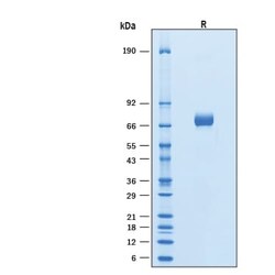 R DSystems Recombinant Human BTN2A1 Fc Chimera Protein, CF 50 &mu;g | Buy Online | R&amp;DSystems&trade; | Fisher Scientific