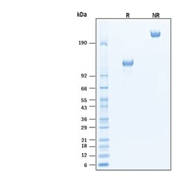 R DSystems Recombinant Rat EGFR mFc Chimera Protein, CF 50 &mu;g | Buy Online | R&amp;DSystems&trade; | Fisher Scientific