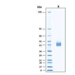 R&D Systems&trade;&nbsp;Recombinant Human DPEP1 His-tag Protein, CF