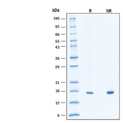 R DSystems Recombinant Human KGF/FGF-7 Protein, CF 500 &mu;g | Buy Online | R&amp;DSystems&trade; | Fisher Scientific