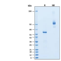 R D Systems Recombinant Mouse R-Spondin 1 Fc Chimera Protein, CF 1 mg | Buy Online | R&amp;D Systems&trade; | Fisher Scientific