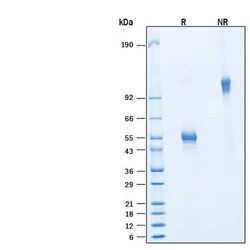 R D Systems Recombinant Human CD160 Fc Chimera Protein, CF 50 &mu;g | Buy Online | R&amp;D Systems&trade; | Fisher Scientific