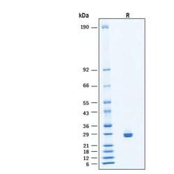 R D Systems Recombinant Human Collagen IV alpha 1/Arresten Protein, CF 50 &mu;g | Buy Online | R&amp;D Systems&trade; | Fisher Scientific