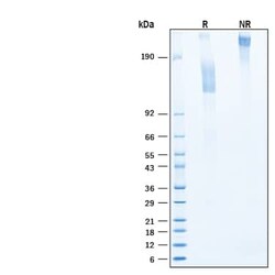 R D Systems Recombinant Human CD44 (CHO-expressed) Fc Protein, CF 50 &mu;g | Buy Online | R&amp;D Systems&trade; | Fisher Scientific