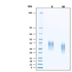 R&D Systems&trade;&nbsp;Recombinant Human Fc gamma RIIIB/CD16b/NA1 His Protein, CF