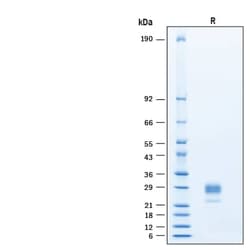 R&D Systems&trade;&nbsp;Recombinant Mouse IL-34 His-tag Protein, CF