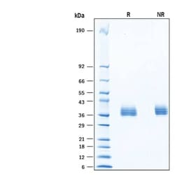 R&D Systems&trade;&nbsp;Recombinant Human PPT1 HA-tag His-tag Protein, CF