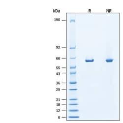 R&D Systems&trade;&nbsp;Recombinant Human PGM1 His-tag Protein, CF