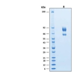 R D Systems Recombinant Human IL-2R beta Fc/IL-2R gamma Fc Protein, CF 50 &mu;g | Buy Online | R&amp;D Systems&trade; | Fisher Scientific