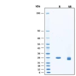 R&D Systems&trade;&nbsp;Recombinant S. cerevisiae SUMO Protease ULP1 His Protein, CF