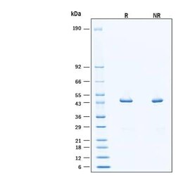 R D Systems Recombinant SUMO-GFP Protease Substrate Protein, CF 100 &mu;g | Buy Online | R&amp;D Systems&trade; | Fisher Scientific