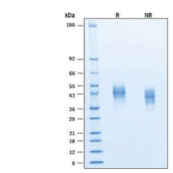 R D Systems Recombinant Human Fc gamma RIIIB/CD16b/SH His Protein, CF 50 &mu;g | Buy Online | R&amp;D Systems&trade; | Fisher Scientific