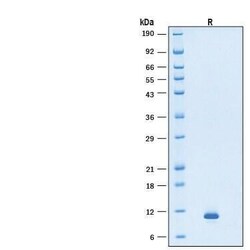 R D Systems Recombinant Human HB-EGF (E. coli-expressed) Protein, CF 100 &mu;g | Buy Online | R&amp;D Systems&trade; | Fisher Scientific