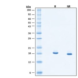 R&D Systems&trade;&nbsp;Recombinant Mouse PGLYRP1/PGRP-S His-tag Protein, CF