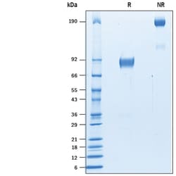 R D Systems Recombinant Mouse SIRP beta 1a Fc Chimera Protein 50 &mu;g | Buy Online | R&amp;D Systems&trade; | Fisher Scientific