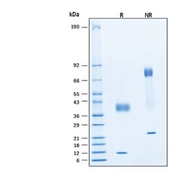 R D Systems Recombinant Human Latent TGF-beta 1 Protein, CF 50 &mu;g | Buy Online | R&amp;D Systems&trade; | Fisher Scientific