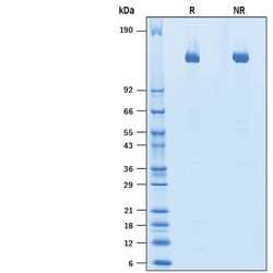 R&D Systems&trade;&nbsp;Recombinant Human ALK/CD246 His-tag Protein