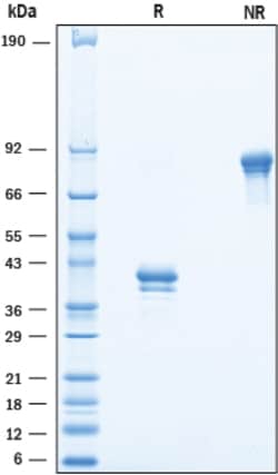 R D Systems Recombinant Cynomolgus/Rhesus Macaque BCMA Fc Protein 50 &mu;g | Buy Online | R&amp;D Systems&trade; | Fisher Scientific