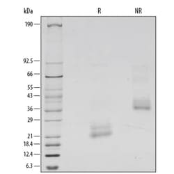 R D Systems Recombinant Human BMP-4 Protein, CF 20 &mu;g | Buy Online | R&amp;D Systems&trade; | Fisher Scientific