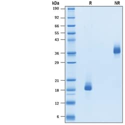 R D Systems Recombinant Rat BMP-6 Protein 20 &mu;g | Buy Online | R&amp;D Systems&trade; | Fisher Scientific