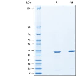 R&D Systems&trade;&nbsp;Recombinant E. coli BirA His-tag Protein