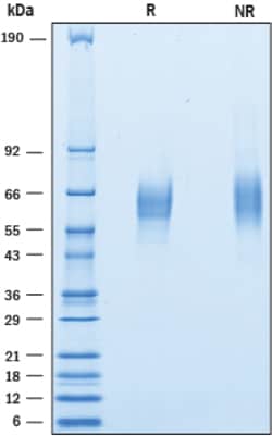 R&D Systems&trade;&nbsp;Recombinant Mouse CD200R1 His-tag Protein
