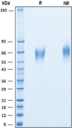 R D Systems Recombinant Cynomolgus CD200R1 His-tag Protein 50 &mu;g | Buy Online | R&amp;D Systems&trade; | Fisher Scientific