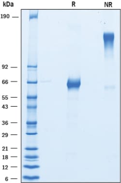 R D Systems Recombinant Cynomolgus/Rhesus Macaque CD27 Fc Protein 100 &mu;g | Buy Online | R&amp;D Systems&trade; | Fisher Scientific