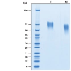 R&D Systems&trade;&nbsp;Recombinant Human CD30/TNFRSF8 His-tag Avi-tag Protein