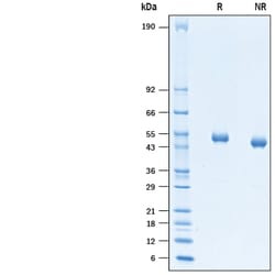 R D Systems Recombinant Human CD4 Protein 100 &mu;g | Buy Online | R&amp;D Systems&trade; | Fisher Scientific