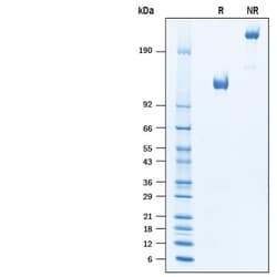 R D Systems Recombinant Human CD68/SR-D1 Fc Chimera Protein 50 μg | Buy Online | R&D Systems™ | Fisher Scientific