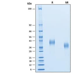 R&D Systems&trade;&nbsp;Recombinant Cynomolgus Monkey CD7 His-tag Protein