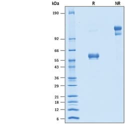 R&D Systems&trade;&nbsp;Recombinant Human CD94 Fc Chimera Protein