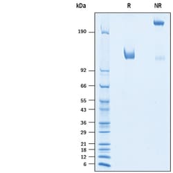 R D Systems Recombinant Human CDCP1 Fc Chimera Protein 50 μg | Buy Online | R&D Systems™ | Fisher Scientific