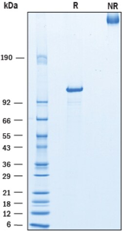 R D Systems Recombinant Human COMP His-tag Protein, CF 50 &mu;g | Buy Online | R&amp;D Systems&trade; | Fisher Scientific