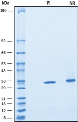 R&D Systems&trade;&nbsp;Recombinant Mouse CTRP4/C1qTNF4 His-tag Protein