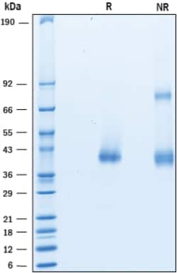 R&D Systems&trade;&nbsp;Recombinant Mouse CTRP9/C1qTNF9 His-tag Protein