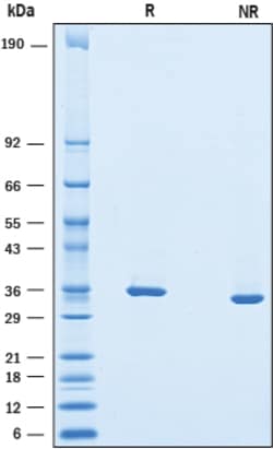 R&D Systems&trade;&nbsp;Recombinant Mouse Chondroadherin His-tag Protein