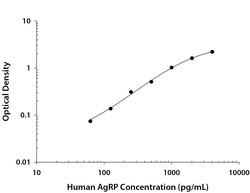 R D Systems Human AgRP DuoSet ELISA 15 x 96-well Plates | Buy Online | R&amp;D Systems&trade; | Fisher Scientific