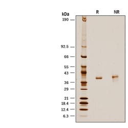 R&D Systems&trade;&nbsp;Recombinant Human D-Amino Acid Oxidase His-tag Protein