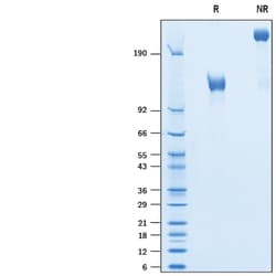 R D Systems Recombinant Cynomolgus Monkey EGFR Fc Chimera Protein 100 &mu;g | Buy Online | R&amp;D Systems&trade; | Fisher Scientific