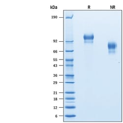 R&D Systems&trade;&nbsp;Recombinant Human E-Selectin/CD62E His-tag Protein