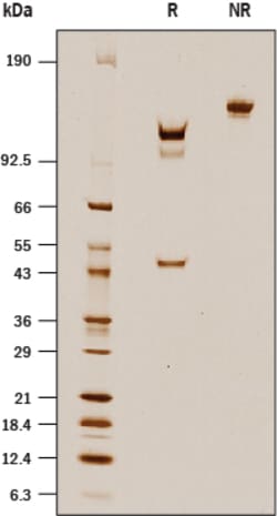R&D Systems&trade;&nbsp;Recombinant Human Enteropeptidase/Enterokinase Protein