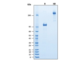 R D Systems Recombinant Mouse FGFR1 Fc Chimera Protein 50 &mu;g | Buy Online | R&amp;D Systems&trade; | Fisher Scientific