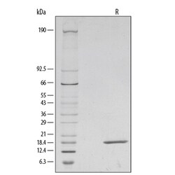 R D Systems Recombinant Human FGF basic/FGF2/bFGF (146 aa) Protein 10 &mu;g | Buy Online | R&amp;D Systems&trade; | Fisher Scientific