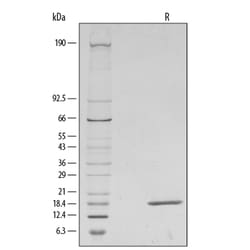 R D Systems Recombinant Human FGF basic/FGF2/bFGF (146 aa) Protein 10 &mu;g | Buy Online | R&amp;D Systems&trade; | Fisher Scientific