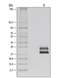 R D Systems Recombinant Human Flt-3 Ligand/FLT3L Protein 250 &mu;g | Buy Online | R&amp;D Systems&trade; | Fisher Scientific