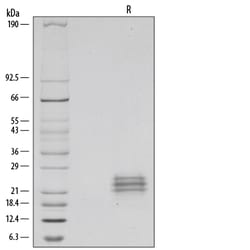 R D Systems Recombinant Human Flt-3 Ligand/FLT3L Protein 100 &mu;g | Buy Online | R&amp;D Systems&trade; | Fisher Scientific